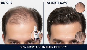 FEG Plus Hair Regrowth Serum (50ml)